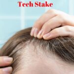 Peptides for Hair Loss: Everything You Need to Know